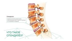 Болести на гръбначния стълб и гръб: техните имена, симптоми и лечение