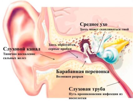 Факторите, които водят до шум в ушите