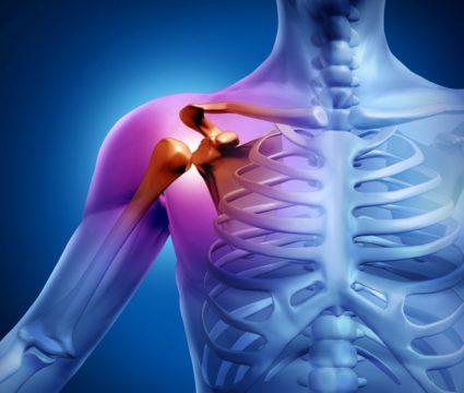 Как да се лекува артрит на раменната става?