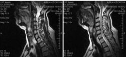 ЯМР на гръбначния стълб: какво показва процедурата и къде да я премине
