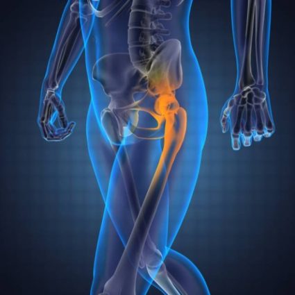 Остеоартрит на тазобедрената става - сериозно заболяване на мускулно-скелетната система