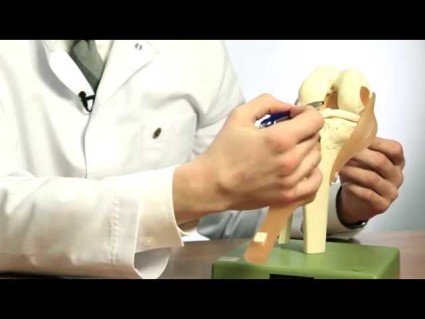Симптоми и лечение на хемартроза на коляното