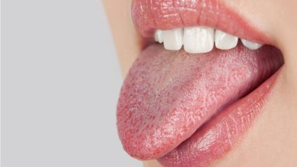 Какво причинява сухота в устата?