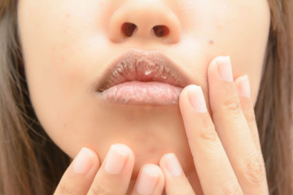 Какво причинява сухота в устата?