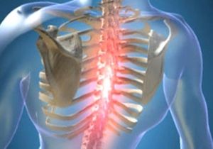 Болка в гърба между лопатките: причини и корекция на това състояние