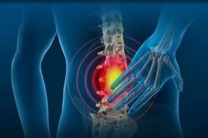 Рак на гръбнака: класификация на това заболяване, неговите симптоми и лечение