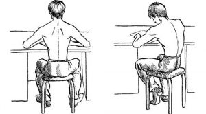 Причини и степени на сколиоза на лумбалния гръбначен стълб