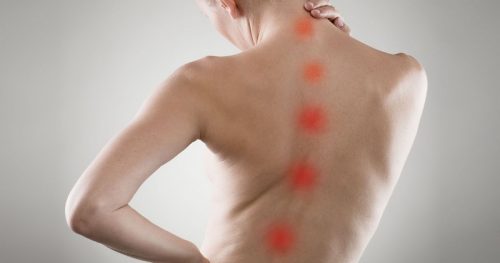 Причини за изгаряне в задната част с остеохондроза