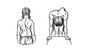 Степени и признаци на kyphoscoliosis на гръбначния стълб