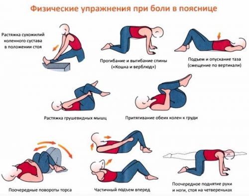 Упражнения за гърба със спондилоза на лумбалния гръбнак