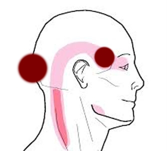 Как треморът на главата се проявява при остеохондроза на шията?