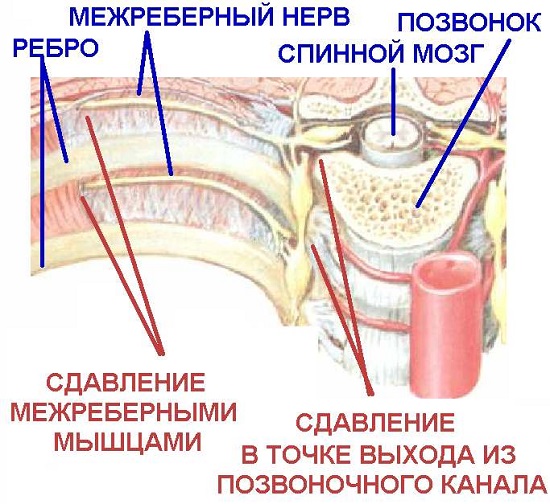 Проявление на кашлица в гръдния кош и цервикална остеохондроза
