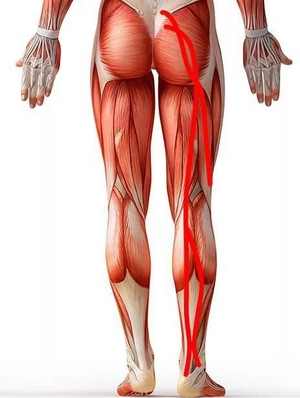 Притискане на нерва в крака: прояви и начини за коригиране на това състояние