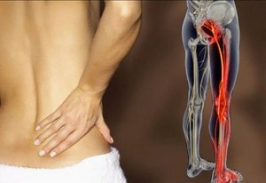 Стеноза на гръбначния канал: причини, симптоми и методи на лечение
