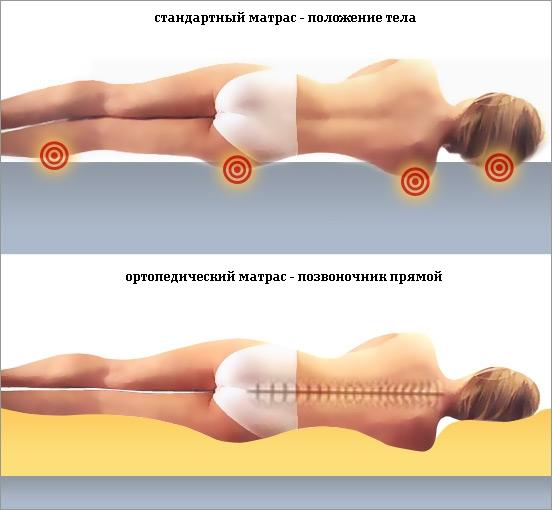 Симптоми и лечение на остеоартрит на гръбначния стълб и периферните стави