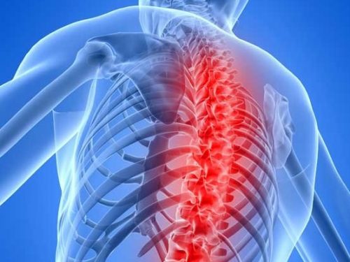 Основните симптоми и опасност от гръдна миелопатия