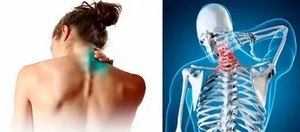 Вратът боли от лявата страна: възможните причини и методи на лечение