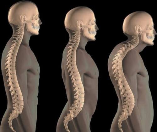 Какви са причините за появата на гърба на гърба на човек?