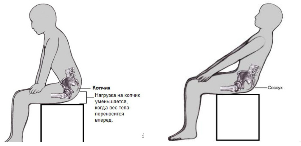Какво трябва да направите, ако болният при краката боли, когато седнете и ставате?