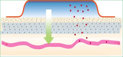 Подробно описание на мазилката Nanoplast Forte