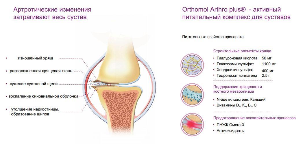 Характеристики на Orthomol Arthro Plus