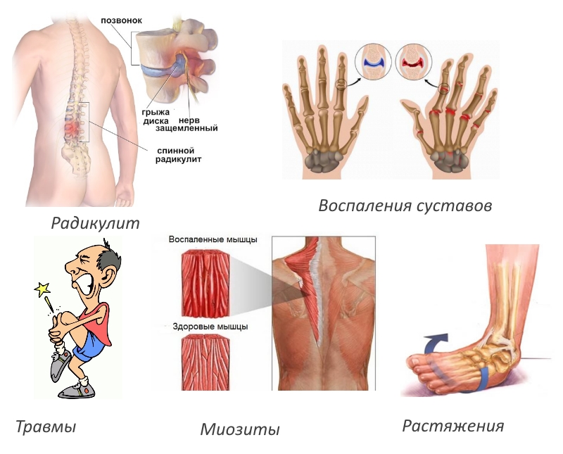 Характеристики на приложението на мехлем Kobrotaksan за лечение на стави