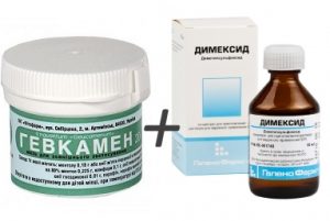 Gavkamen - модерна мехлема за лечение на стави