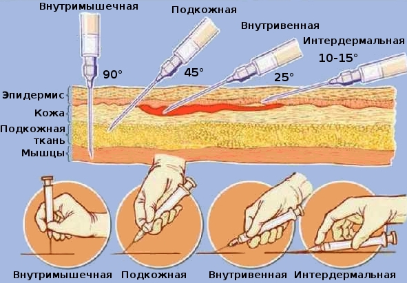 Приготвяне на калцитрин при заболявания на костната тъкан
