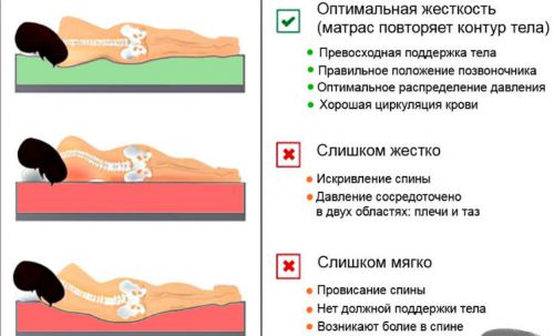 Как най-добре да спите с цервикална остеохондроза