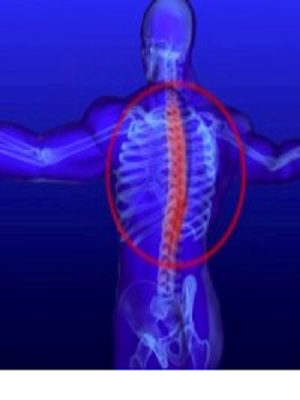 Болка в долната част на гърба и между лопатките