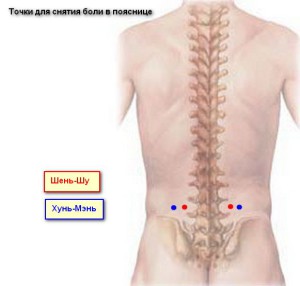 Точки от болки в гърба