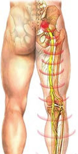 Слабост и болка в краката и долната част на гърба