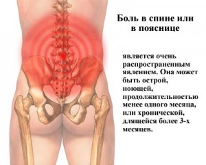 Мехлеми за болки в гърба и долната част на гърба