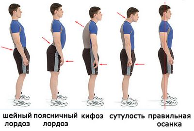 Укрепване на мускулите на гърба и стойката