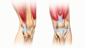 Лечение на колянни връзки