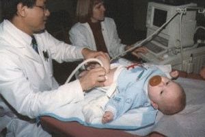 Ултразвук на тазобедрените стави на новородените