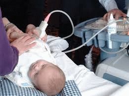 Ултразвук на тазобедрените стави на новородените