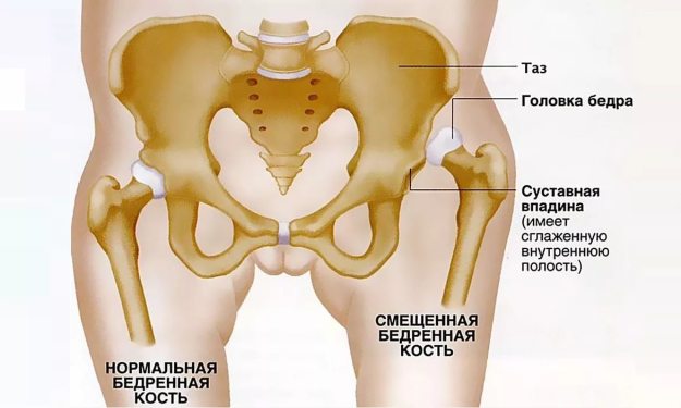 Остеотомия - особености на процедурата