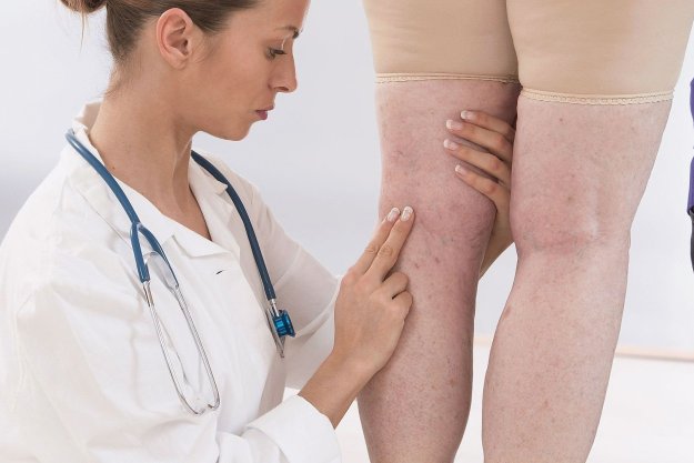 Кракът боли - на това, което лекарите да се обърнат