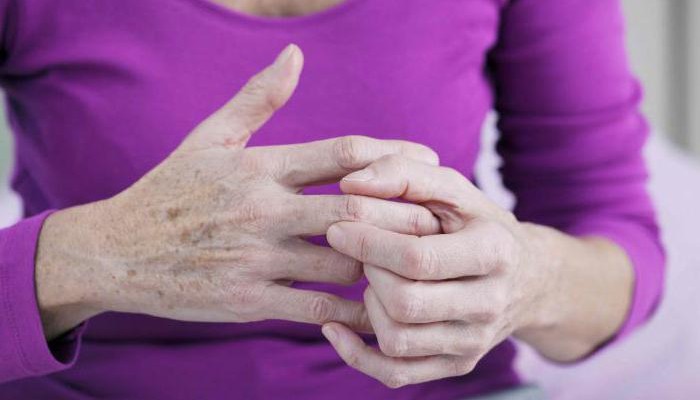 Остеоартрит на малки стави на ръцете: лечение