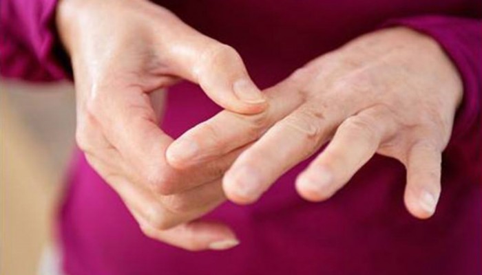 А за лечение на артрит на ставите на пръстите на ръцете?