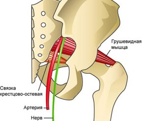 Как се влияе щипката на седалищния нерв от крушовидния мускул