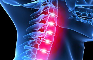 Остеохондроза на цервикалния гръбначен стълб: как да се определи присъствието и лечението
