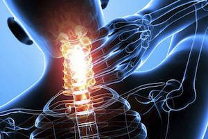 Изместване на прешлените на цервикалната част при остеохондроза: диагностика и лечение