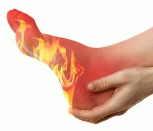 Причини за болка и изгаряне на краката