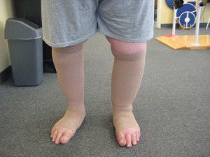 Причини за подуване на пръстите на краката