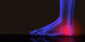 Ефективни мехлеми за болки в краката