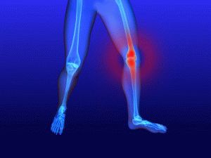 Как да се лекува болка в коляното отстрани отвътре