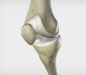 Как да се лекува болка в коляното странично отвън
