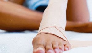Как да премахнете подуване на крака след нараняване